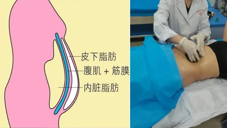 1753531849629641.jpg 1753531849629641.jpg