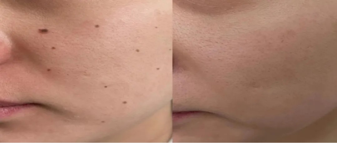 1753543683687002.jpg 1753543683687002.jpg