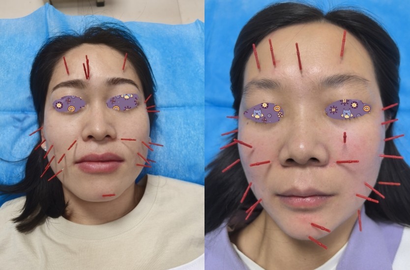 1753549562455878.jpg 1753549562455878.jpg